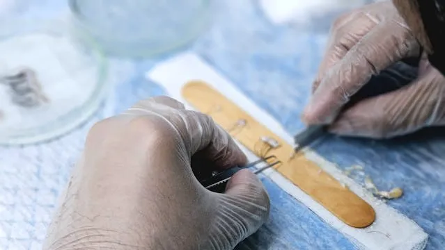 Understanding Hair Transplantation